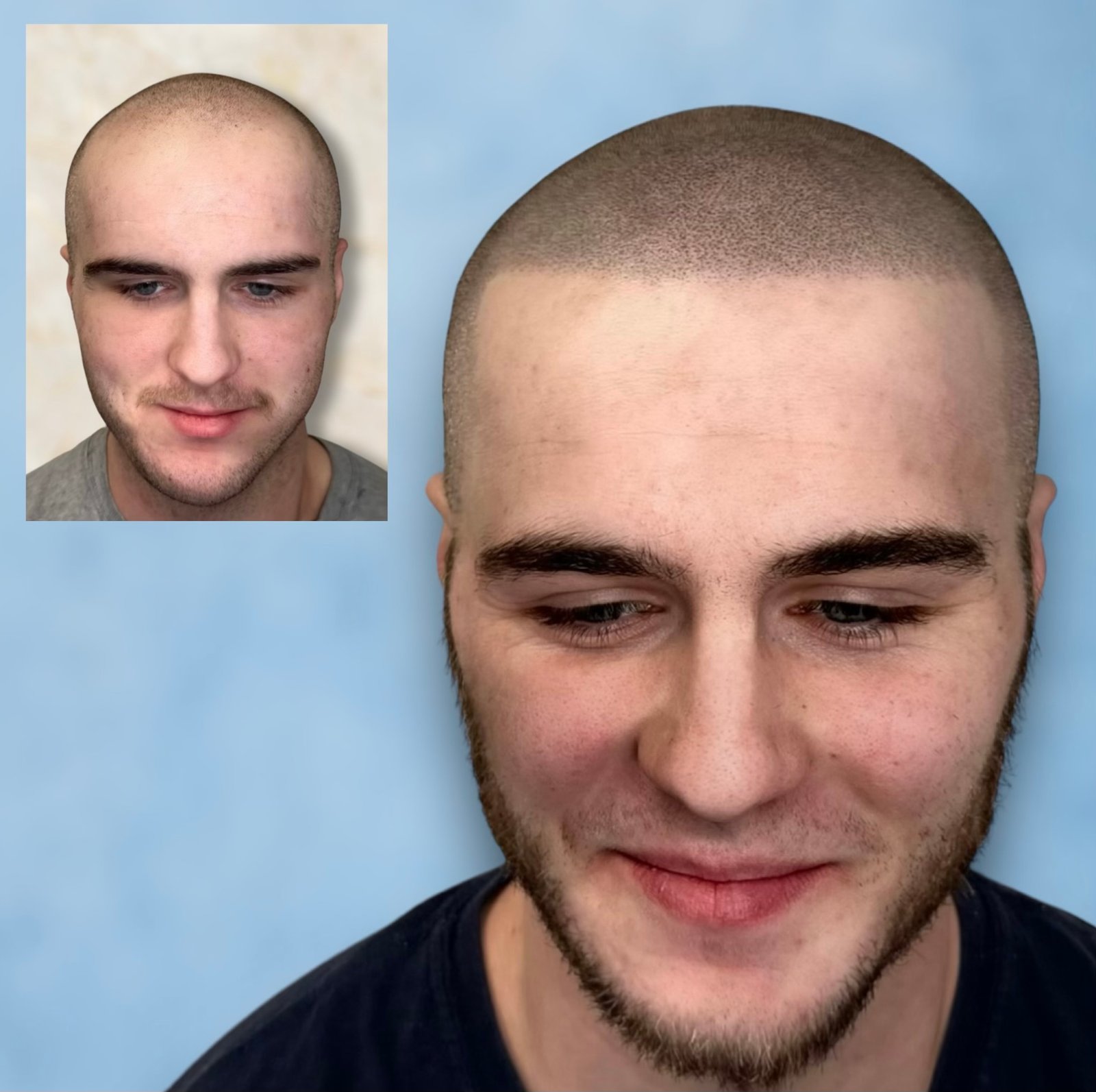 {PinterestId: 190777}