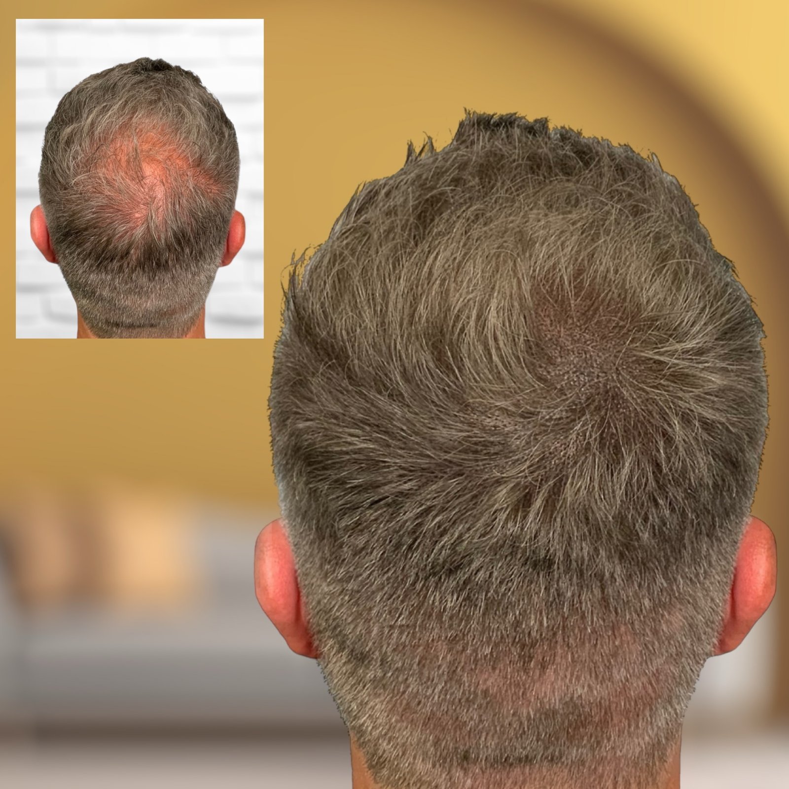 {PinterestId: 190777}